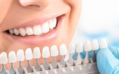 The Do’s and Dont’s of Teeth Whitening: A Comprehensive Guide