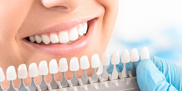 The Do’s and Dont’s of Teeth Whitening: A Comprehensive Guide